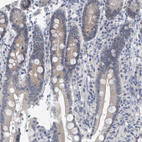 Anti-FAM83H Antibody