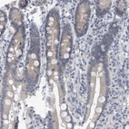 Immunohistochemical staining of human duodenum shows weak cytoplasmic positivity in glandular cells.