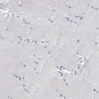 Immunohistochemical staining of human skeletal muscle shows no positivity in myocytes as expected.