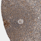 Immunohistochemical staining of human Spleen shows moderate cytoplasmic positivity in cells in white pulp.