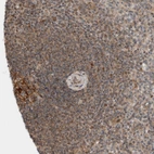 Immunohistochemical staining of human Spleen shows moderate cytoplasmic positivity in cells in white pulp.