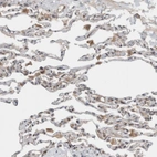 Immunohistochemical staining of human Lung shows moderate cytoplasmic positivity in pneumocytes.