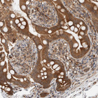 Anti-KLHL6 Antibody