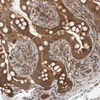 Immunohistochemical staining of human Small intestine shows moderate cytoplasmic positivity in glandular cells.