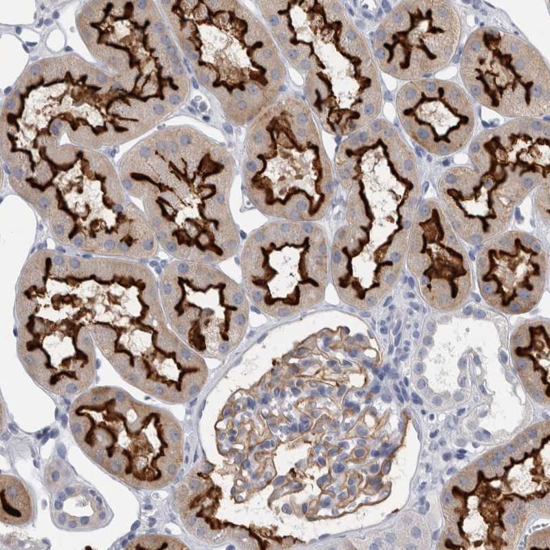 Anti-ANKFY1 Antibody