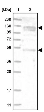 Lane 1: Marker [kDa] 230, 130, 95, 72, 56, 36, 28, 17, 11_br/_Lane 2: Human cell line RT-4