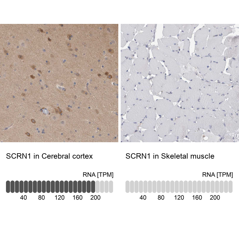Anti-SCRN1 Antibody