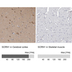 Anti-SCRN1 Antibody