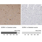 Anti-SCRN1 Antibody