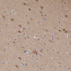 Immunohistochemical staining of human cerebral cortex shows high expression.