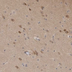 Immunohistochemical staining of human cerebral cortex shows high expression.