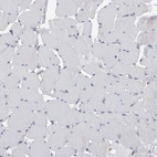 Immunohistochemical staining of human skeletal muscle shows low expression as expected.