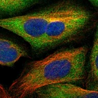 Immunofluorescent staining of human cell line U-2 OS shows localization to cytosol.
