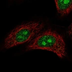 Immunofluorescent staining of human cell line A549 shows localization to nucleus & nucleoli.