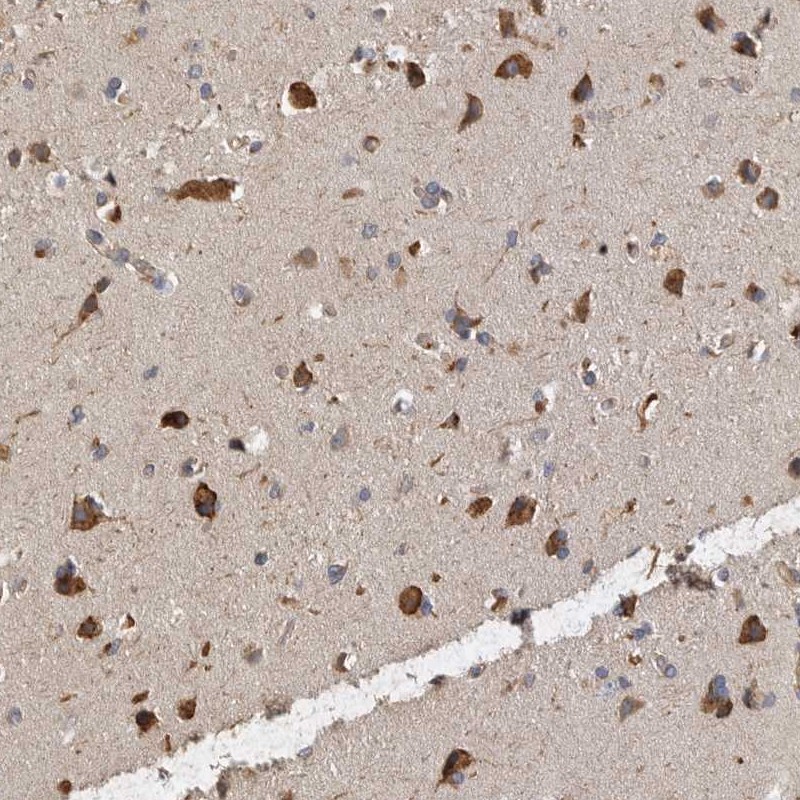 Anti-ANKFY1 Antibody