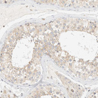 Immunohistochemical staining of human testis shows moderate cytoplasmic positivity in cells in seminiferous ducts.