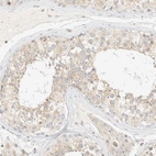 Immunohistochemical staining of human testis shows moderate cytoplasmic positivity in cells in seminiferous ducts.
