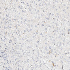 Immunohistochemical staining of human liver shows no positivity in hepatocytes as expected.