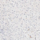 Immunohistochemical staining of human liver shows no positivity in hepatocytes as expected.