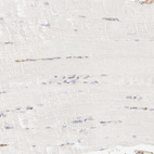 Immunohistochemical staining of human skeletal muscle shows no positivity in myocytes as expected.