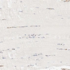 Immunohistochemical staining of human skeletal muscle shows no positivity in myocytes as expected.