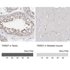 Anti-TDRD7 Antibody