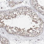 Immunohistochemical staining of human testis shows moderate nucleoli-nucleus /cytoplasmic positivity in cells in seminiferous ducts and leydig cells.