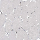 Immunohistochemical staining of human skeletal muscle shows no positivity in myocytes as expected.