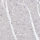 Immunohistochemical staining of human heart muscle shows no positivity in cardiomyocytes as expected.