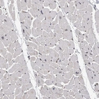 Immunohistochemical staining of human heart muscle shows no positivity in cardiomyocytes as expected.