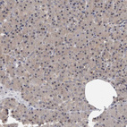 Anti-TDRD7 Antibody