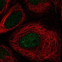 Anti-TSEN54 Antibody