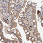 Anti-B3GNTL1 Antibody