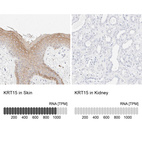 Anti-KRT15 Antibody