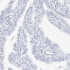 Immunohistochemical staining of human fallopian tube shows no positivity in glandular cells as expected.