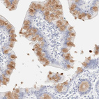 Anti-KRT15 Antibody