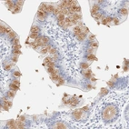Immunohistochemical staining of human small intestine shows strong cytoplasmic positivity in glandular cells.