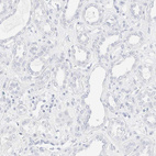 Anti-KRT15 Antibody