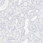 Immunohistochemical staining of human kidney shows no positivity in cells in tubules as expected.