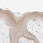 Immunohistochemical staining of human skin shows strong cytoplasmic positivity in squamous epithelial cells.