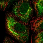 Immunofluorescent staining of human cell line HaCaT shows localization to nucleoplasm & intermediate filaments.
