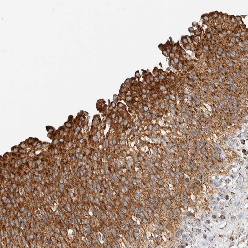 Anti-ZNF454 Antibody