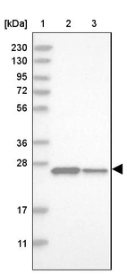Lane 1: Marker [kDa] 230, 130, 95, 72, 56, 36, 28, 17, 11_br/_Lane 2: Human cell line RT-4_br/_Lane 3: Human cell line U-251MG sp