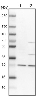 Lane 1: NIH-3T3 cell lysate (Mouse embryonic fibroblast cells)_br/_Lane 2: NBT-II cell lysate (Rat Wistar bladder tumour cells)