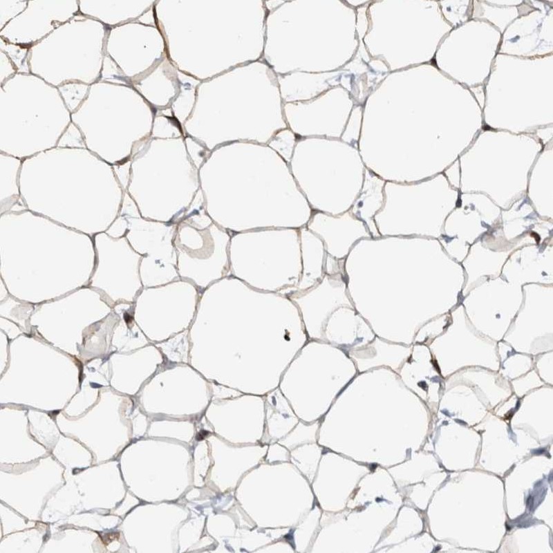 Anti-FAM213A Antibody