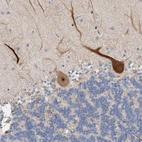 Anti-PRRG4 Antibody