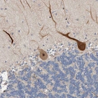 Anti-PRRG4 Antibody
