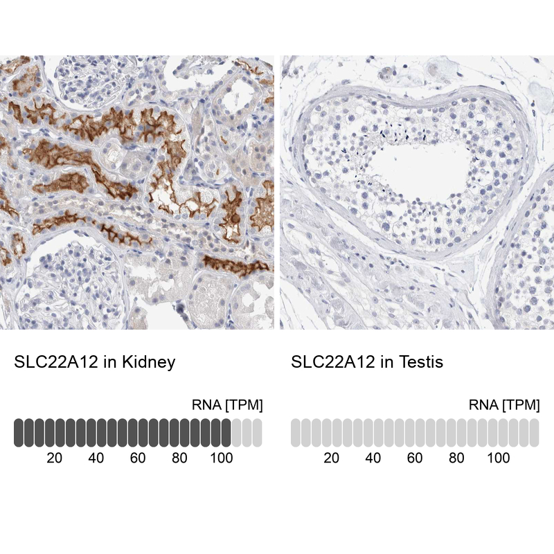 Anti-SLC22A12 Antibody