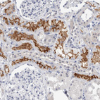 Anti-SLC22A12 Antibody