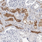 Immunohistochemical staining of human kidney shows strong membranous positivity in cells in tubules.